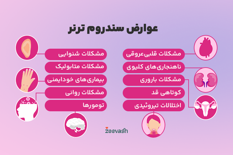 عوارض سندرم ترنر
